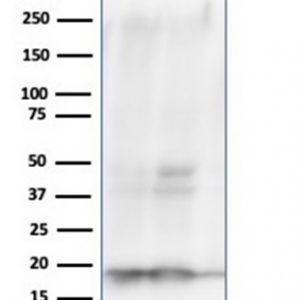 Western Blot Analysis of A549, PC3, K562 cell lysates using NME1 / nm23-H1 Mouse Monoclonal Antibody (NME1/2738).