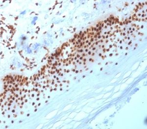 Formalin-fixed, paraffin-embedded human skin stained with Nucleophosmin Mouse Monoclonal Antibody (NA24).