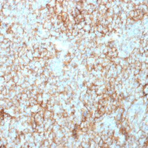 Formalin-fixed, paraffin-embedded human Tonsil stained with CD73 Mouse Monoclonal Antibody (NT5E/2503).
