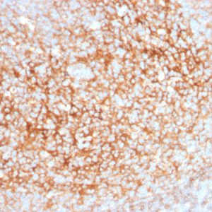 Formalin-fixed, paraffin-embedded human Tonsil stained with CD73 Mouse Monoclonal Antibody (NT5E/2545).