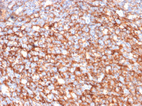 Formalin-fixed, paraffin-embedded human Tonsil stained with CD73 Mouse Monoclonal Antibody (NT5E/2646).