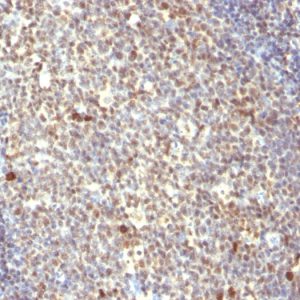 Formalin-fixed, paraffin-embedded human Tonsil stained with NuMA Mouse Monoclonal Antibody (SPM300).