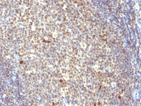 Formalin-fixed, paraffin-embedded human Tonsil stained with NuMA Mouse Monoclonal Antibody (SPM300).