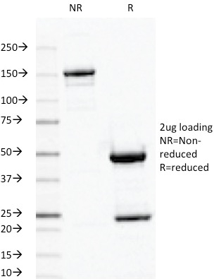 SDS-PAGE Analysis Purified ODC1 MAb (ODC1/487). Confirmation of Integrity and Purity of Antibody.