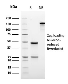SDS-PAGE Analysis Purified ODC-1 Recombinant Mouse Monoclonal Antibody (rODC1/485). Confirmation of Purity and Integrity of Antibody.