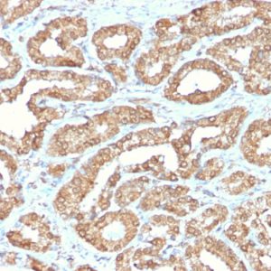 Formalin-fixed, paraffin-embedded human Prostate stained with ODC1 Rabbit Recombinant Monoclonal Antibody (ODC1/2878R).