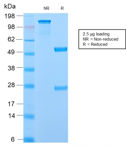 SDS-PAGE Analysis Purified ODC1 Rabbit Recombinant Monoclonal Ab (ODC1/2878R). Confirmation of Purity and Integrity of Antibody.