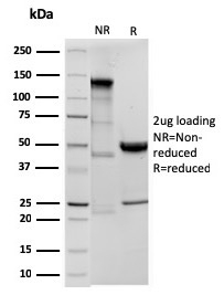 SDS-PAGE Analysis of Purified ODC-1 Recombinant Rabbit Monoclonal Antibody (ODC1/3636R). Confirmation of Purity and Integrity of Antibody.