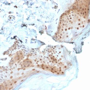 Formalin-fixed, paraffin-embedded human Skin stained with 8-oxoguanine Mouse Monoclonal Antibody (CPTC-OGG1-1).