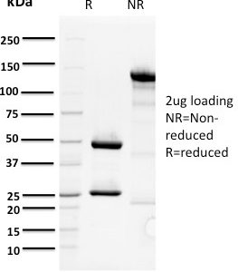 SDS-PAGE Analysis of Purified ORC1 Mouse Monoclonal Antibody (7F6/1). Confirmation of Purity and Integrity of Antibody.
