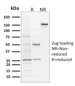 SDS-PAGE Analysis of Purified Langerin Mouse Monoclonal Antibody (LGRN/1821). Confirmation of Integrity and Purity of Antibody.