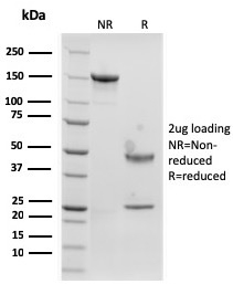 SDS-PAGE Analysis of Purified Langerin Recombinant Mouse Monoclonal Antibody (rLGRN/1821). Confirmation of Integrity and Purity of Antibody.