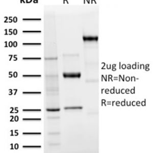 SDS-PAGE Analysis of Purified Langerin Recombinant Rabbit Monoclonal Antibody (LGRN/3136R). Confirmation of Integrity and Purity of Antibody.