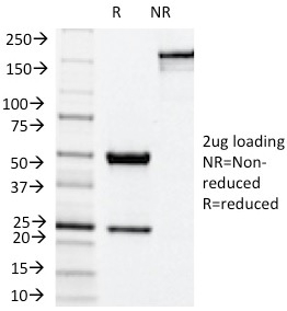 SDS-PAGE Analysis Purified NOX4 Mouse Monoclonal Antibody (NOX4/1245). Confirmation of Integrity and Purity of Antibody