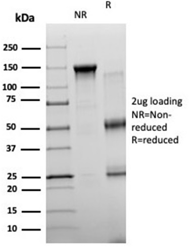Immunofluorescence Analysis of PFA-fixed HeLa cells stained using NEUROG3 Mouse Monoclonal Antibody (PCRP-NEUROG3-1E10) followed by goat anti-mouse IgG-CF488 (green). CF640A phalloidin (red).