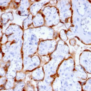 Formalin-fixed, paraffin-embedded human Placenta stained with PAPP-A Mouse Monoclonal Antibody (PAPPA/2715).