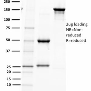 SDS-PAGE Analysis Purified PAX5 Mouse Monoclonal Antibody (PAX5/2595). Confirmation of Purity and Integrity