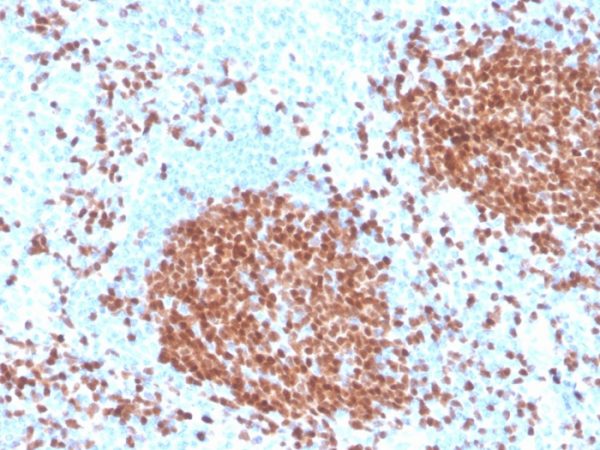 Formalin-fixed, paraffin-embedded human tonsil stained with PAX5 Recombinant Mouse Monoclonal Antibody (rPAX5/4228).