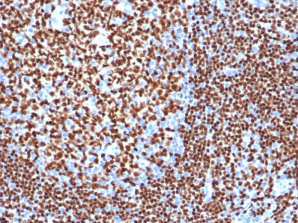Formalin-fixed, paraffin-embedded human tonsil stained with PAX5 Recombinant Rabbit Monoclonal Antibody (PAX5/3977R).