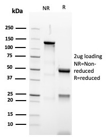 SDS-PAGE Analysis of Purified PAX5 Recombinant Rabbit Monoclonal Antibody (PAX5/3977R). Confirmation of Purity and Integrity of Antibody.