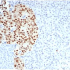 Formalin-fixed, paraffin-embedded human pancreas stained with PAX6 Recombinant Rabbit Monoclonal Antibody (PAX6/7078R). Inset: PBS instead of primary antibody; secondary only negative control.