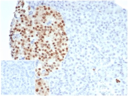 Formalin-fixed, paraffin-embedded human pancreas stained with PAX6 Recombinant Rabbit Monoclonal Antibody (PAX6/7078R). Inset: PBS instead of primary antibody; secondary only negative control.