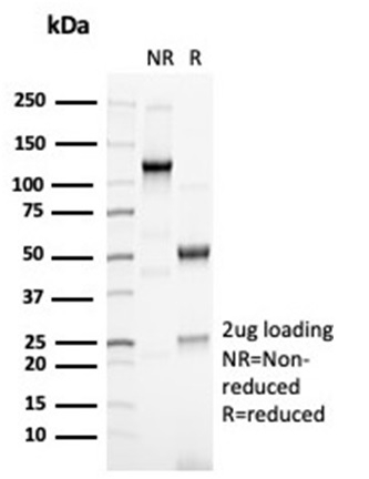 SDS-PAGE Analysis of Purified PAX6 Recombinant Rabbit Monoclonal Antibody (PAX6/7078R). Confirmation of Purity and Integrity of Antibody.
