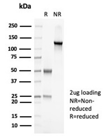 SDS-PAGE Analysis Purified PAX7 Recombinant Rabbit Monoclonal Antibody (PAX7/7079R). Confirmation of Integrity and Purity of Antibody.