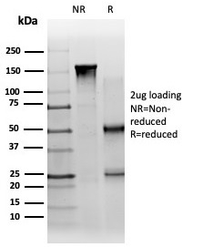 SDS-PAGE Analysis of Purified PBX1 Mouse Monoclonal Antibody (PCRP-PBX1-3C8). Confirmation of Integrity and Purity of Antibody.