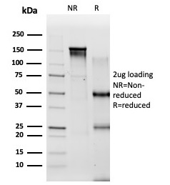 SDS-PAGE Analysis of Purified PBX2 Mouse Monoclonal Antibody (PCRP-PBX2-1C4). Confirmation of Integrity and Purity of Antibody.