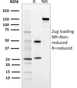 SDS-PAGE Analysis Purified FOXP3 Mouse Monoclonal Antibody (3G3). Confirmation of Purity and Integrity of Antibody.