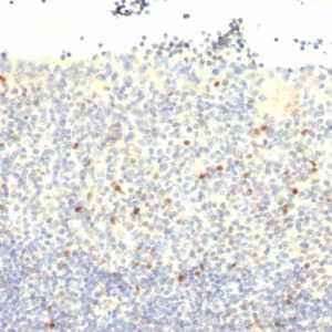 Formalin-fixed, paraffin-embedded human Tonsil stained with FOXP3 Monoclonal Antibody (FXP3/197).