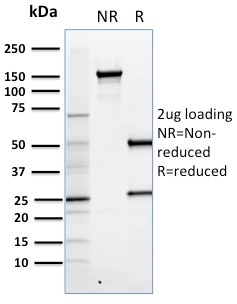 SDS-PAGE Analysis of Purified FOXP3 Mouse Monoclonal Antibody (FXP3/197). Confirmation of Purity and Integrity of Antibody.