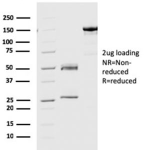 SDS-PAGE Analysis Purified Geminin Mouse Monoclonal Antibody (CPTC-GMNN-1). Confirmation of Purity and Integrity of Antibody.