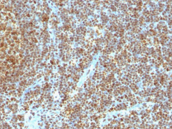 Formalin-fixed, paraffin-embedded human Tonsil stained with PCNA Mouse Monoclonal Antibody (SPM350).