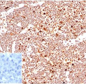 Formalin-fixed, paraffin-embedded human lymph nodestained with PCNA Mouse Monoclonal Antibody (PCNA/6580)at 2ug/ml. Inset: PBS instead of primary antibody; secondary only negative control