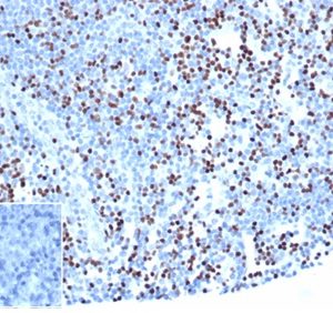 IHC analysis of formalin-fixed, paraffin-embedded human lymph node. Strong nuclear staining of non-germinal center cells using rLEF1/6906 at 2ug/ml in PBS for 30min RT. Inset: PBS instead of primary. Secondary antibody negative control.