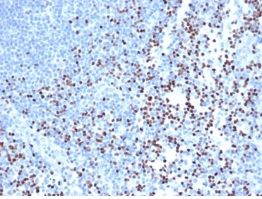 IHC analysis of formalin-fixed, paraffin-embedded human lymph node. Strong nuclear staining of non-germinal center cells using rLEF1/6906 at 2ug/ml in PBS for 30min RT. HIER: Tris/EDTA, pH9.0, 45min. 2°C: HRP-polymer, 30min. DAB, 5min.