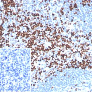IHC analysis of formalin-fixed, paraffin-embedded human tonsil. Strong nuclear staining of non-germinal center cells using LEF1/341R at 2ug/ml in PBS for 30min RT. HIER: Tris/EDTA, pH9.0, 45min. 2 °: HRP-polymer, 30min. DAB, 5min.Inset: PBS instead of primary. Secondary antibody negative control.