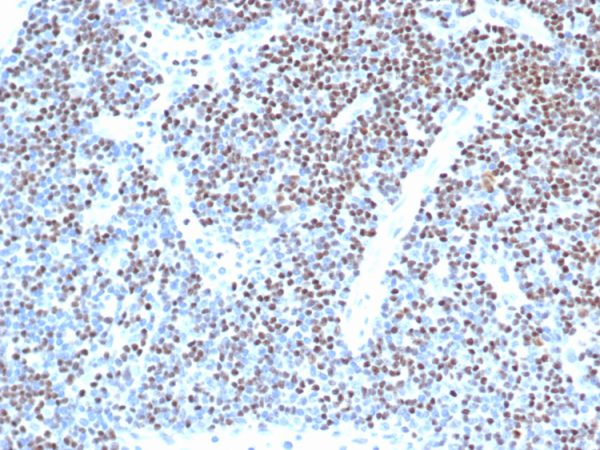 IHC analysis of formalin-fixed, paraffin-embedded human lymph node. Strong nuclear staining of non-germinal center cells using LEF1/341R at 2ug/ml in PBS for 30min RT. HIER: Tris/EDTA, pH9.0, 45min. 2 °: HRP-polymer, 30min. DAB, 5min.