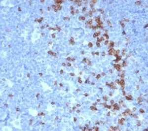 Formalin-fixed, paraffin-embedded human tonsil stained with PD1 (CD279) Mouse Monoclonal Antibody (PDCD1/7125). HIER: Tris/EDTA, pH9.0, 45min. 2 °: HRP-polymer, 30min. DAB, 5min.