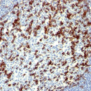 Formalin-fixed, paraffin-embedded human Tonsil stained with PD1 (CD279) Monoclonal Antibody (NAT105).