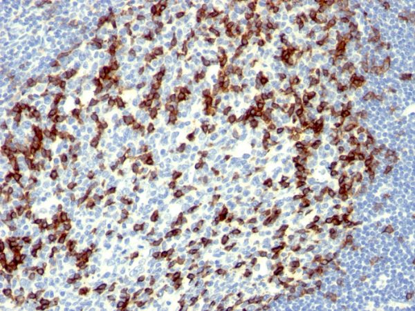 Formalin-fixed, paraffin-embedded human Tonsil stained with PD1 (CD279) Monoclonal Antibody (NAT105).