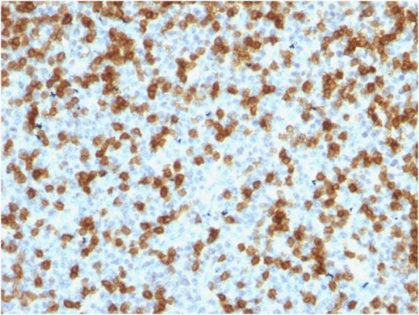 Formalin-fixed, paraffin-embedded human Tonsil stained with PD1 (CD279) Rabbit Recombinant Monoclonal Antibody (PDCD1/1410R).