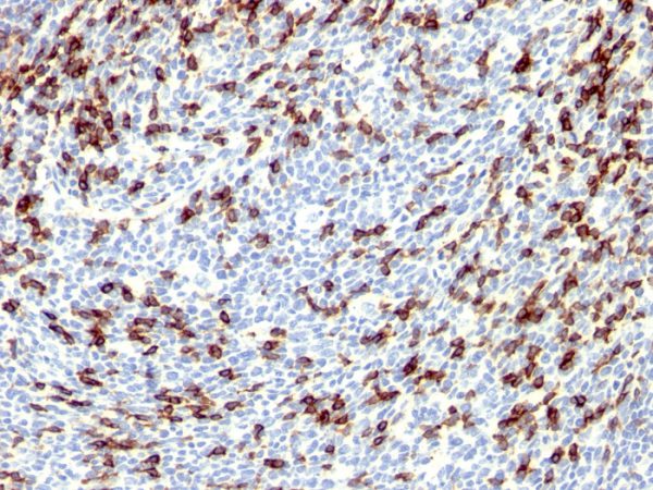 Formalin-fixed, paraffin-embedded human Tonsil stained with PD1 (CD279) Rabbit Polyclonal Antibody.