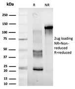 SDS-PAGE Analysis of Purified DDX41 Mouse Monoclonal Antibody (PCRP-DDX41-1B4). Confirmation of Purity and Integrity of Antibody.