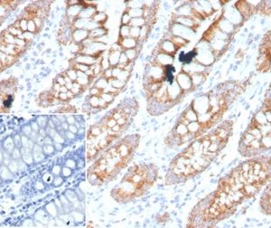 Formalin-fixed, paraffin-embedded human colon stained with PDGF beta Mouse Monoclonal Antibody (PDGFB/3071). Inset: PBS instead of primary antibody, secondary antibody negative control.