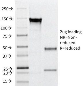 SDS-PAGE Analysis of Purified CD31 Mouse Monoclonal Antibody (C31.12). Confirmation of Integrity and Purity of Antibody.