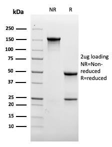 SDS-PAGE Analysis of Purified CD31 Recombinant Mouse Monoclonal Antibody (rC31.3). Confirmation of Purity and Integrity of Antibody.