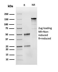 SDS-PAGE Analysis Purified CD31 Mouse Monoclonal Antibody (PECAM1/3525). Confirmation of Integrity and Purity of Antibody.